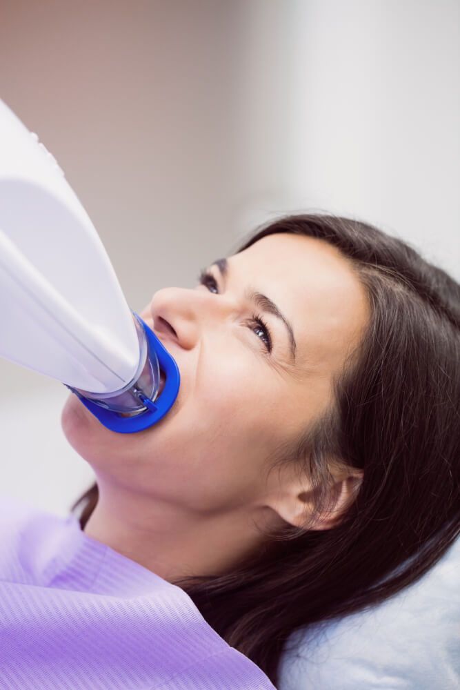 65432 (1) blanqueamiento dental clínica dental