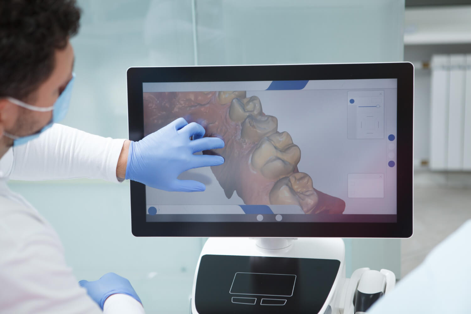 escaner intraoral
