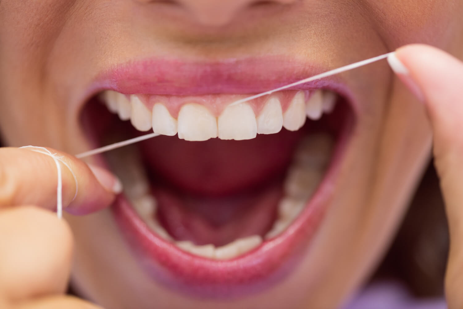 boca abierta pasándose el hilo dental